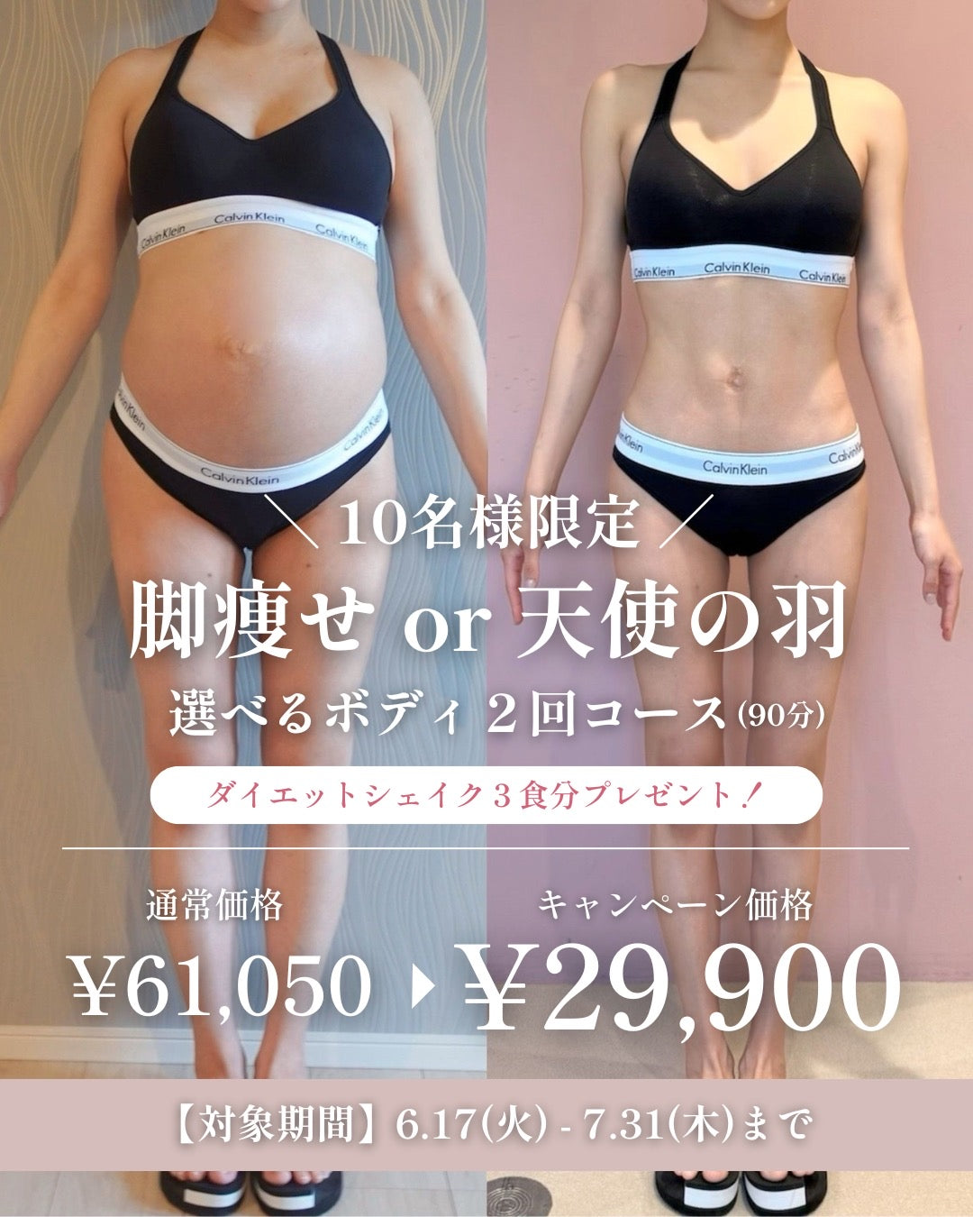 夏の足痩せキャンペーン